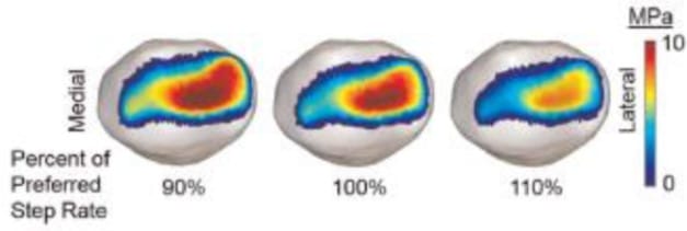 Wat is de juiste looptechniek bij kniepijn?